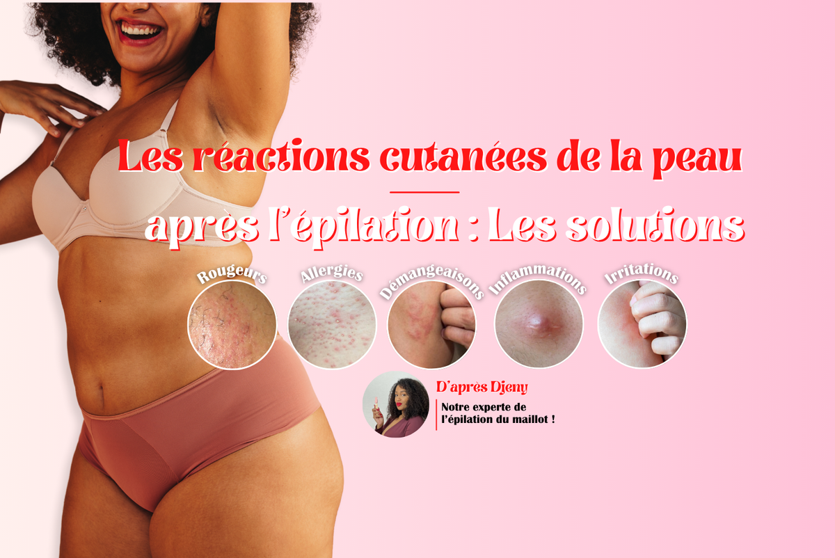 réactions cutanées après épilation