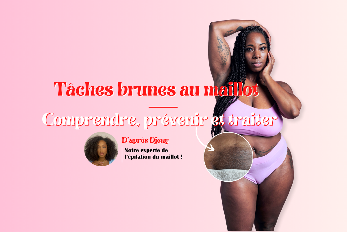 tâches brunes