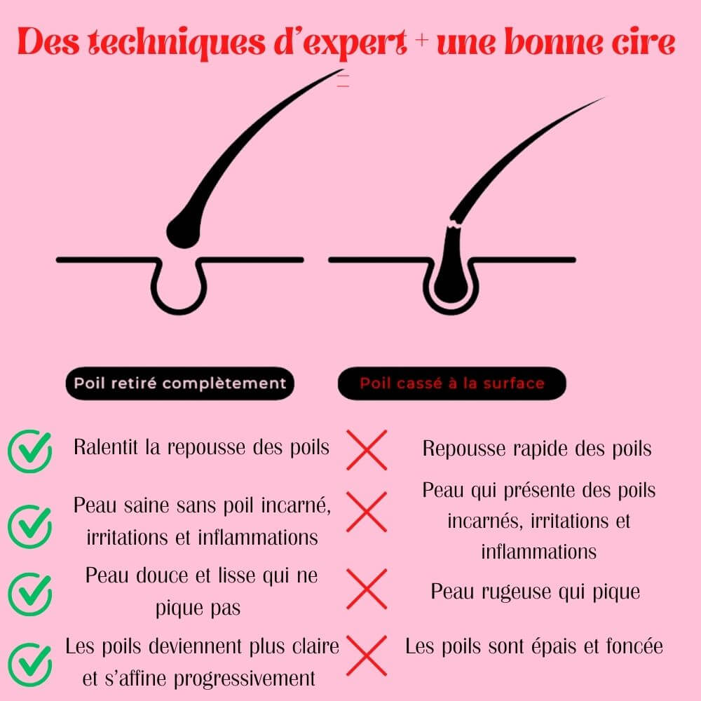 Des technique d'expert